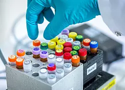 K&uuml;nftig sollen auch Patente f&uuml;r gentechnisch ver&auml;nderte Pflanzen m&ouml;glich sein. - &copy; Jens B&uuml;ttner/dpa