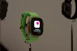 Achtung, möglicher Bluthochdruck entdeckt. Die Apple Watches können nun auch auf optischem Weg den Blutdruck ihrer Trägerinnen und Träger im Auge behalten. - © Andrej Sokolow/dpa-tmn/dpa