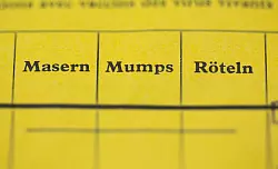 Gegen Masern, Mumps und R&ouml;teln gibt es auch Kombi-Impfstoffe. (Symbolbild) - &copy; picture alliance / Lukas Schulze/dpa