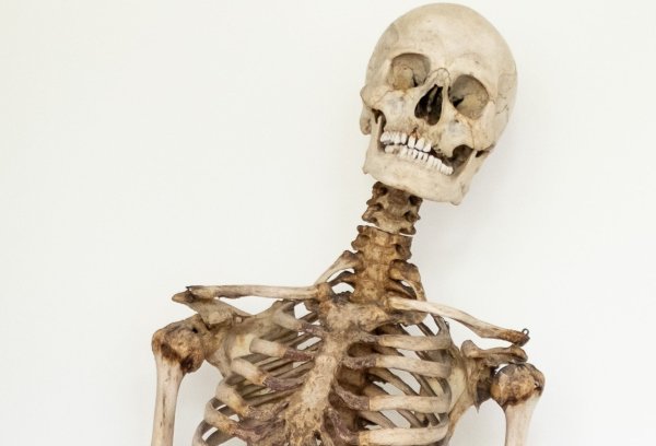 Dank wissenschaftlicher Analysen und eines Verwandten weiß man nun, dass dieses Skelett die sterblichen Überreste des Räubers Schinderhannes sind. - © Sara Doll/Medizinische Fakultät Heidelberg/dpa