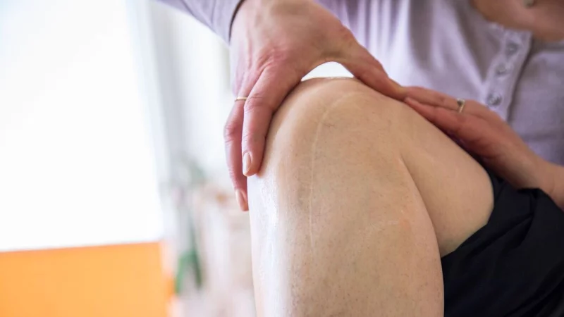 Es geht nicht nur ums Aussehen: Narben, die unsch&ouml;n verheilen, sind manchmal auch ein medizinisches Problem. - &copy; Christin Klose/dpa-tmn