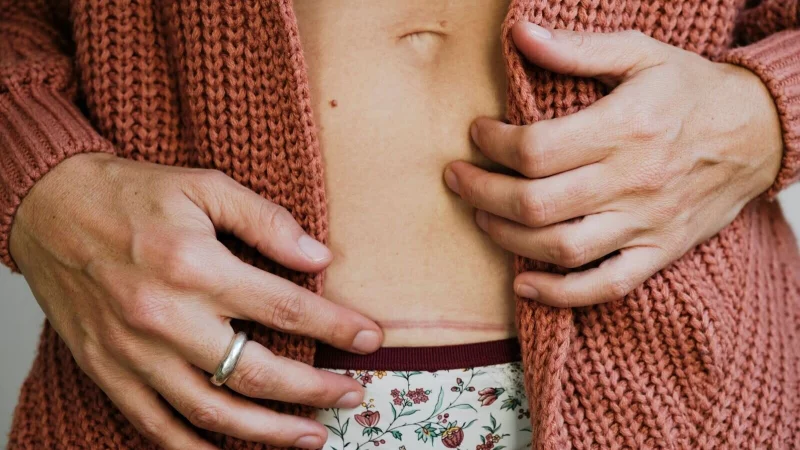 Sanfte Massagen und wenig Spannung: Das tut frischen Narben gut. - &copy; Gemma Ferrando/Westend61/dpa-tmn