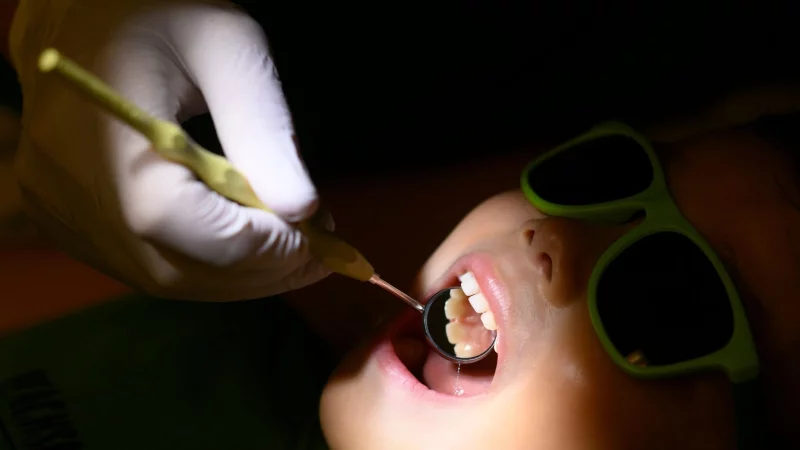 Gesetzliche Krankenkassen &uuml;bernehmen regelm&auml;&szlig;ige Zahnarztchecks. - &copy; Julian Stratenschulte/dpa/dpa-tmn