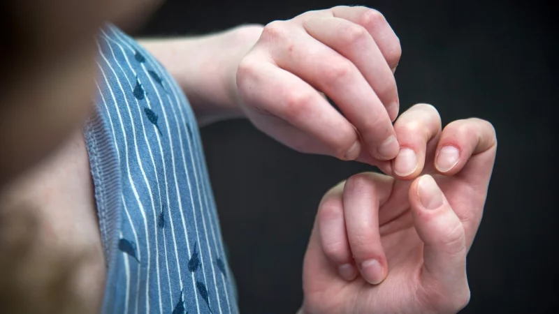 K&ouml;rperfokussierte repetitive Verhaltensweisen sind weit verbreitet: Sie dienen oft als Bew&auml;ltigungsstrategie f&uuml;r Stress, Anspannung oder unangenehme Gef&uuml;hle. - &copy; Andrea Warnecke/dpa-tmn