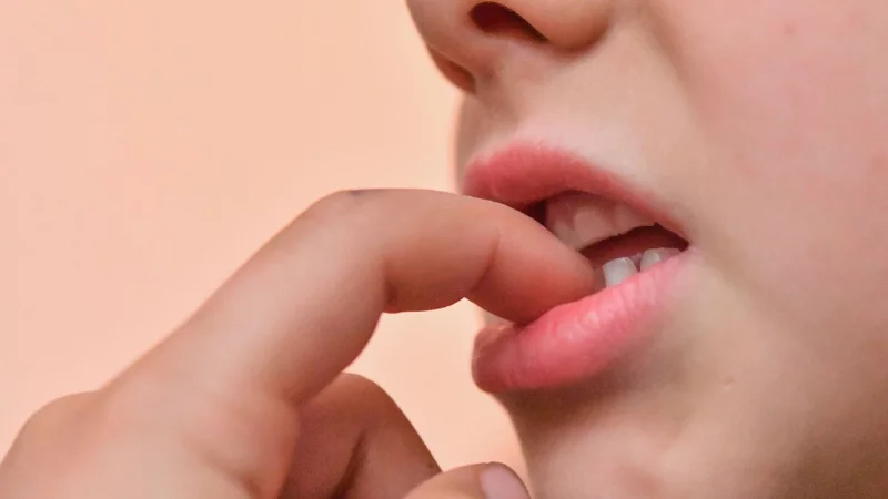 Langeweile, Stress oder Überforderung – Nägelkauen kann verschiedene Ursachen haben. - © Patrick Pleul/dpa/dpa-tmn