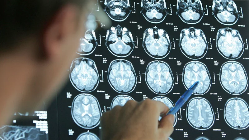 Wer einen Schlaganfall erleidet, ist im Durchschnitt rund 75 Jahre alt. - © Friso Gentsch/dpa/dpa-tmn