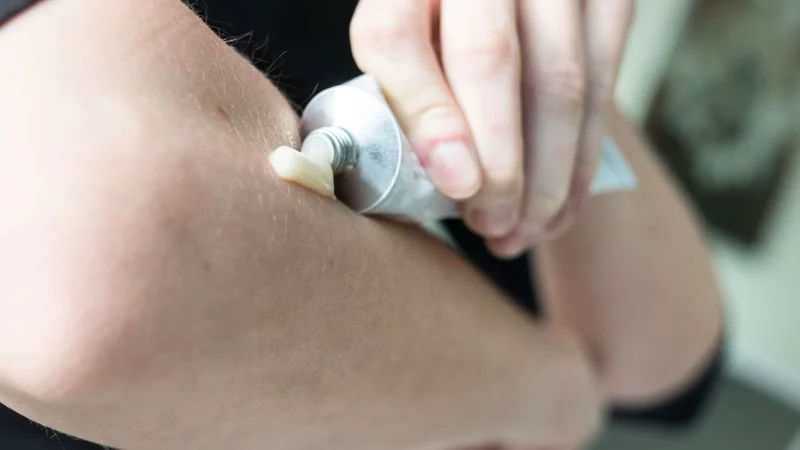 F&uuml;nf Schmerzsalben schneiden bei der Zeitschrift &laquo;&Ouml;ko-Test&raquo; sehr gut ab - drei setzen auf Ibuprofen, jeweils eine auf Piroxicam und Felbinac. - &copy; Franziska Gabbert/dpa-tmn