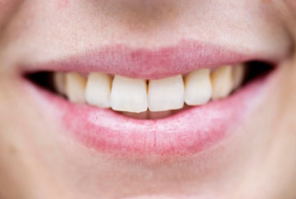 Alle Affen können lachen - aber unter allen Primaten haben nur Menschen eine Sprache herausgebildet. - © picture alliance / dpa