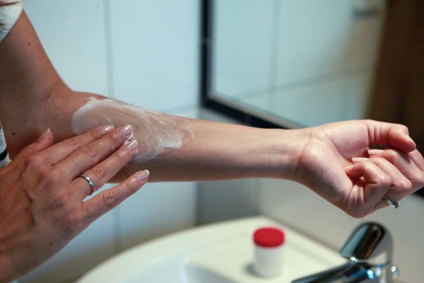 Behandeln lässt sich die Ringelflechte mit einer Salbe, die gegen Fadenpilze wirkt. Selbst wenn die Flecken weg sind, muss noch eine Woche weiterbehandelt werden. - © Silvia Marks/dpa-tmn