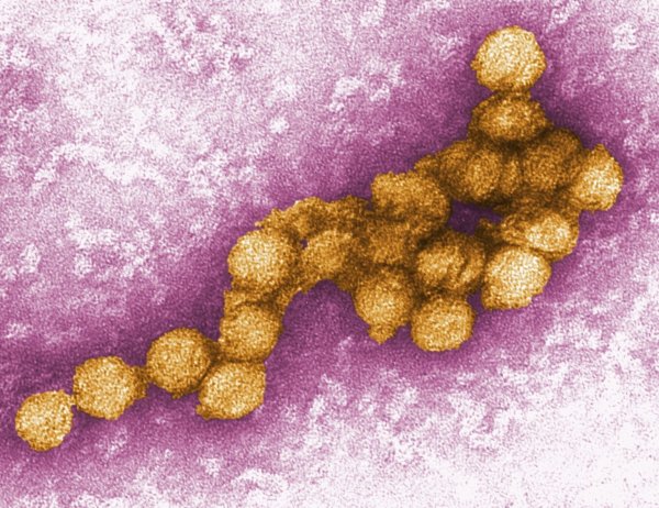 West-Nil-Virus - © Foto: Cynthia Goldsmith/CENTERS FOR DISEASE CONTROL