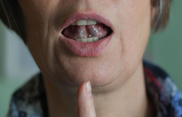 Stotternde Menschen können mit Hilfe von regelmäßigen Sprechübungen ihren Redefluss verbessern. (Symbolbild) - © Jens Kalaene/zb/dpa