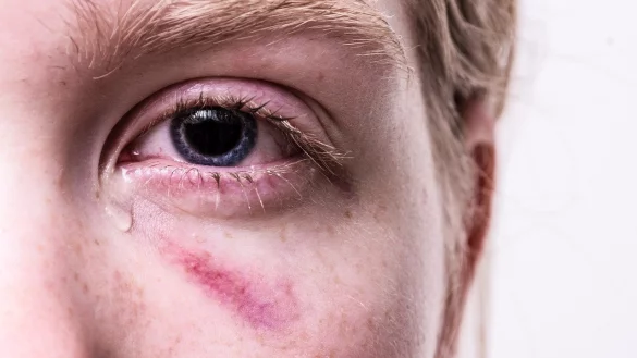 Ein Trauma kann die Seele lange belasten. - &copy; Symbolbild: Pixabay