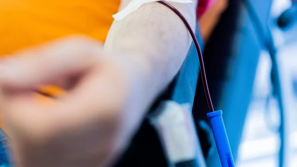 Ein Entwurf des Bundesgesundheitsministeriums sieht konkrete Regelungen vor, um auf die physische Anwesenheit eines Arztes bei der Blutspende verzichten zu können. - © Rolf Vennenbernd