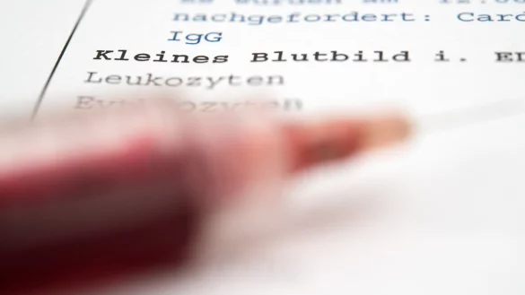 Für ein kleines Blutbild muss eine Blutprobe entnommen werden. Im Klinikalltag werden die Parameter routinemäßig erhoben. Für das Frühwarnsystem von Thorsten Kaiser, das eine Sepsis erkennt, reichen diese Messwerte aus. - © picture alliance