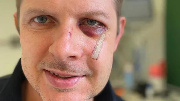 Der SPD-Politiker, Matthias Ecke, &auml;u&szlig;ert sich zum ersten Mal im Interview &uuml;ber die Attacke in Dresden. - &copy; Matthias Ecke/SPD Sachsen/dpa