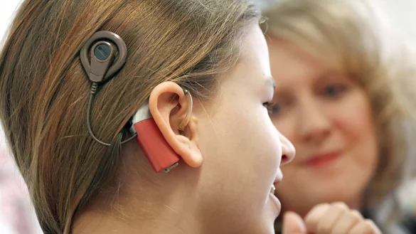 So sieht eine "H&ouml;rprothese", das sogenannte Cochlea-Implantat, von au&szlig;en aus. - &copy; picture-alliance/ dpa