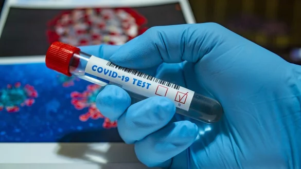 L&auml;ngst nicht alle Corona-Infektionen werden den Gesundheits&auml;mtern gemeldet. - &copy; Pixabay/fernandozhiminaicela