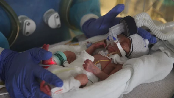 In der Detmolder Kinder- und Familienklinik: ein früh geborenes Mädchen ist noch einige Zeit auf den Inkubator angewiesen. - © Archivfotos: Bernhard Preuss
