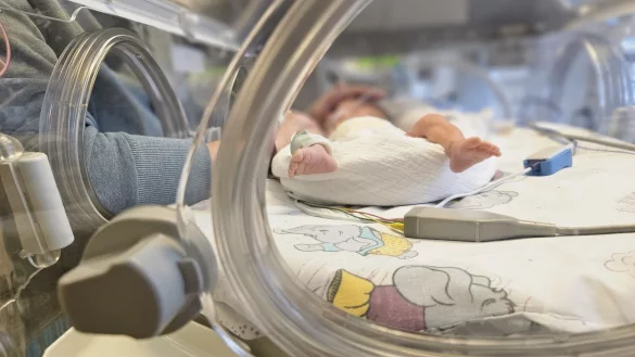 Per Notkaiserschnitt kam dieses kleine Baby in der der 27. Schwangerschaftswoche mit knapp 1000 Gramm zur Welt. Zum Zeitpunkt des Fotos lag das Frühchen schon vier Wochen im Inkubator. - © Janet König