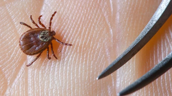 Eine Zecke auf einer Hand - &copy; Foto: Patrick Pleul/dpa-Zentralbild/dpa-tmn