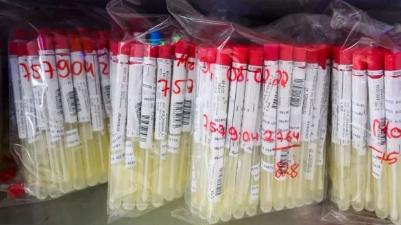 PCR-Test Auswertung im Labor - &copy; Foto: Julian Stratenschulte/dpa