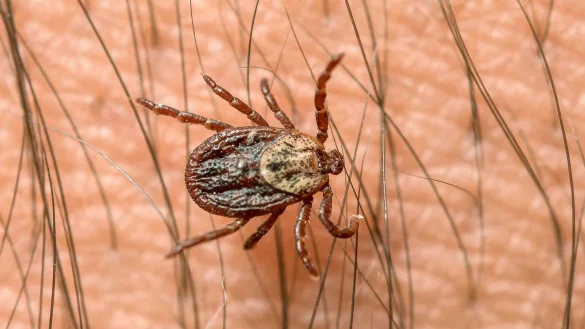 Zecke - &copy; Foto: Patrick Pleul