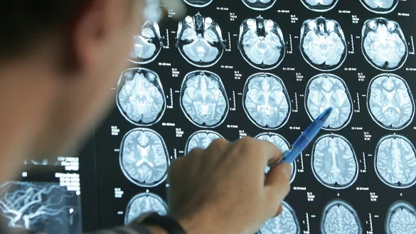 Folgen eines Schlaganfalls - &copy; Foto: Friso Gentsch