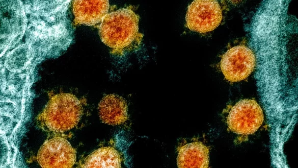 Coronavirus - &copy; Foto: Uncredited/NIAID/NIH/dpa