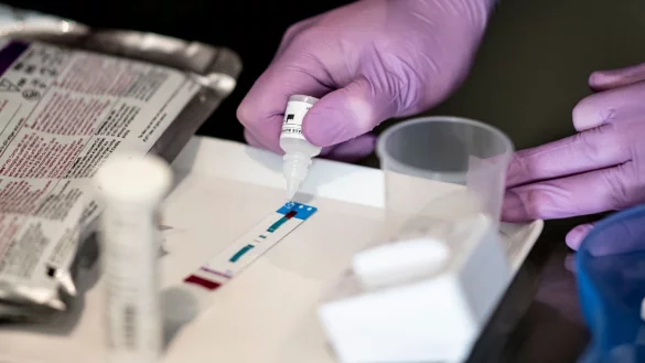 HIV-Schnelltest - &copy; Foto: Fabian Sommer/dpa