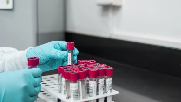 Mehrere Tests sind positiv ausgefallen. - &copy; (Symbolbild): Pixabay