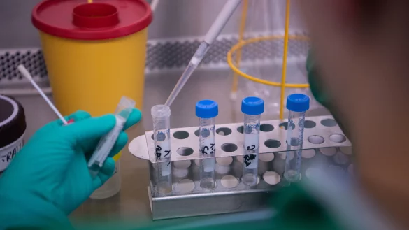 Nur bei F&auml;llen, bei denen ein begr&uuml;ndeter Verdacht auf das Coronavirus bestehe, sei ein Test sinnvoll, so die Experten aus dem Kreis G&uuml;tersloh. - &copy; Symbolfoto/picture alliance