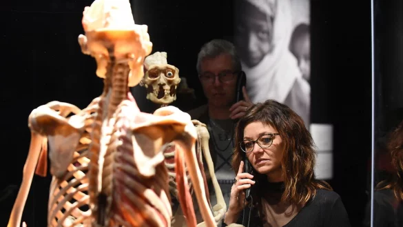 Wie ein Knochenger&uuml;st aussieht, ist hier zu sehen. - &copy; Joseph Carlucci