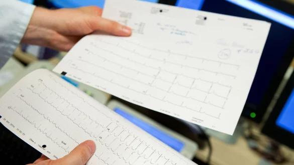 EKG-Auswertung - &copy; Foto: Oliver Krato