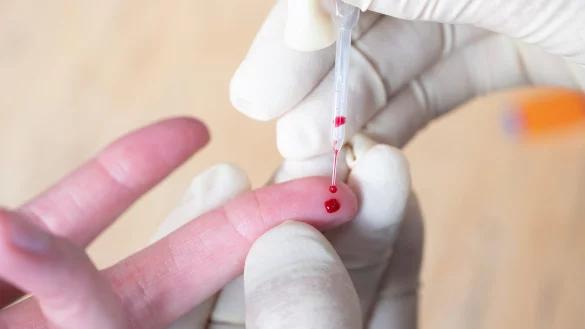 &nbsp;F&uuml;r einen Corona-Antik&ouml;rpertest muss Blut abgenommen werden. - &copy; Daniel Reinhardt