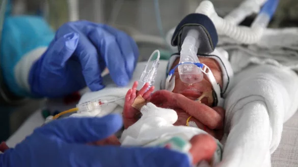 Intensiv versorgt: Ein Frühgeborenes Kind auf der Intensivstation der Familienklinik. - © Bernhard Preuss