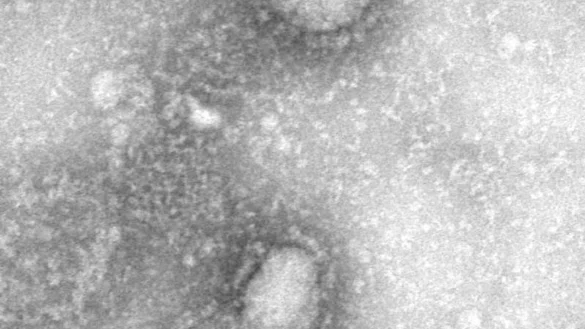 Coronavirus - &copy; Foto: IVDC/China CDC via GISAID/dpa