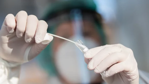 Die PCR-Tests werden im Labor untersucht. - &copy; Foto: Tom Weller/dpa