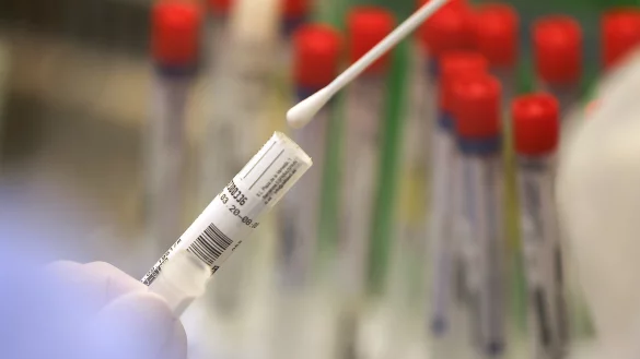 Zum Nachweis einer Infektion werden im Labor Abstriche aus dem Nasen-Rachen-Raum auf das Sars-CoV-2-Virus getestet. Am Klinikum Lippe wird jeder neue Patient getestet, das Personal hingegen nur unter bestimmten Voraussetzungen. - © Oliver Berg/dpa