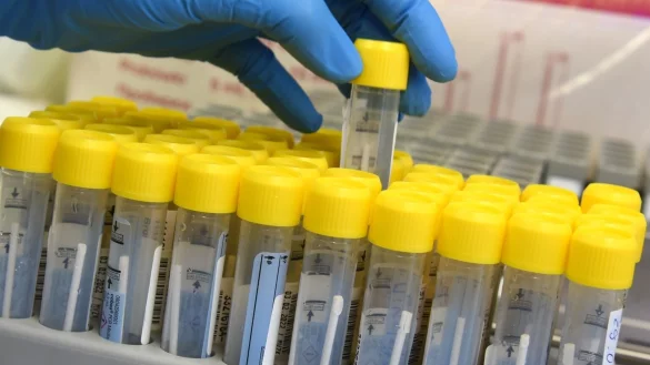 PCR-Tests - &copy; Foto: Waltraud Grubitzsch/dpa