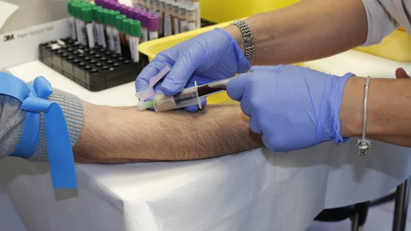 Bluttests auf Coronavirus-Antik&ouml;rper sind eine IGEL-Leistung. Krankenkassen zahlen ihn nicht. - &copy; Symbolfoto: pixabay.com/Antonio Corigliano