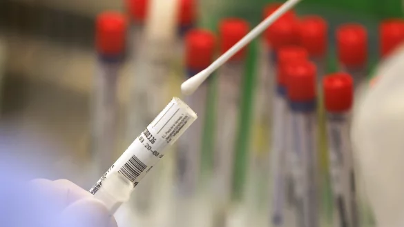 Corona-Test im Labor - &copy; Foto: Oliver Berg/dpa/dpa-tmn