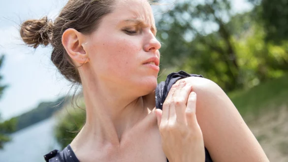 Jucken der Haut - &copy; Foto: Christin Klose