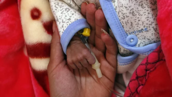 Unterern&auml;hrung im Jemen - &copy; Foto: Mohammed Mohammed/XinHua/dpa