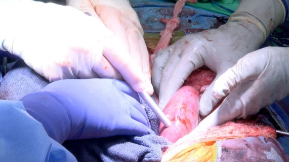 Xenotransplantation - &copy; Foto: Dr. Jayme Locke/UAB News/dpa