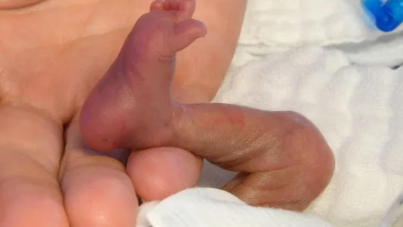 WHO sieht Fr&uuml;hchen in Gefahr - &copy; Foto: Holger Hollemann/dpa