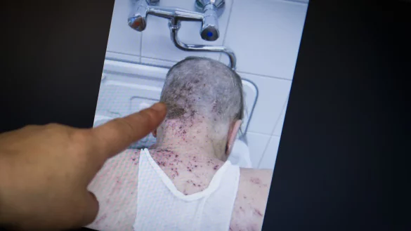 Kr&auml;tze - &copy; Foto: Daniel Naupold