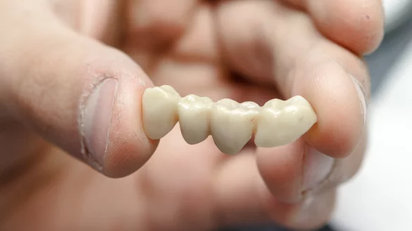 Zahnzusatzversicherungen - &copy; Foto: Markus Scholz/dpa-tmn