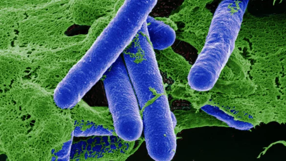 Gefährlich: Diese Erreger lösen die lebensbedrohliche Krankheit Botulismus aus. - © picture-alliance / OKAPIA KG, Germany