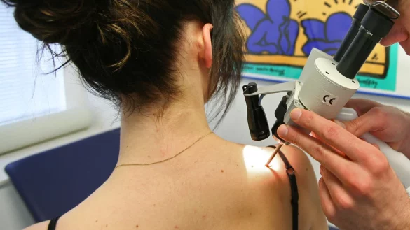 Termine beim Hautarzt sind schwer zu bekommen. Die Wartezeiten sind lang. - &copy; Bernhard Preuss