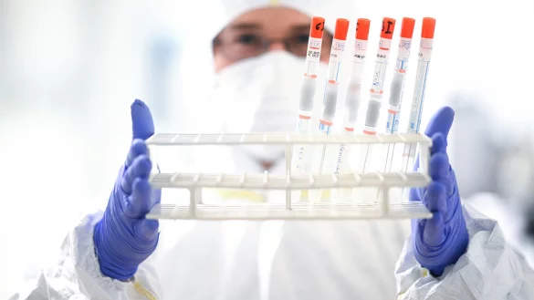 Ein Mitarbeiter des Labors Dr. Blessing h&auml;lt einen St&auml;nder mit diversen Rachenabstrichr&ouml;hrchen in den H&auml;nden. Nach der Virus-Inaktivierung unter der Sicherheitswerkbank werden die R&ouml;hrchen zur weiteren Verarbeitung in einen anderen Laborbereich gebracht. - &copy; Felix K&auml;stle